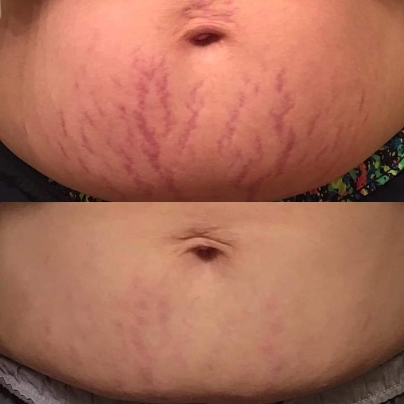 Body butter with tons of uses!! - Picture 4 of 6